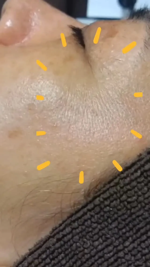 【お肌が別人級‼️】